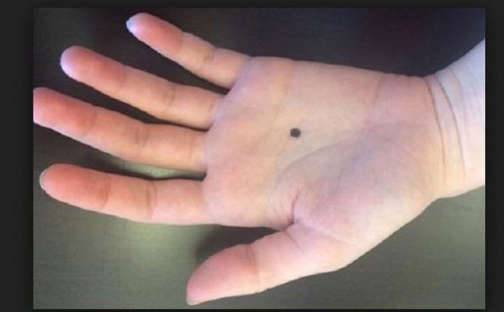 हाथ का ये तिल बताता है कब-तक अमीर बने रह सकते हैं आप