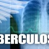 पहले से सरल होगा टीबी का इलाज, कम दवाई में जल्दी ठीक हो जाएगी बीमारी