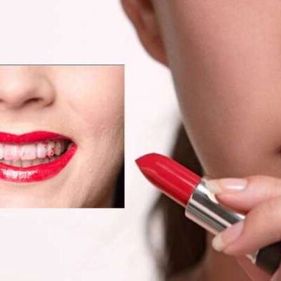 जब दांतों पर लग जाये लिपस्टिक!