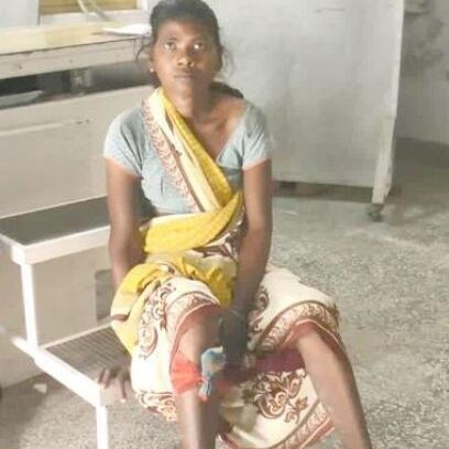 अजीबों बीमारी के चलते महिला के शरीर निकल रही हैं कीलें, ये देख डॉ भी हैं हैरान