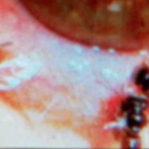 ताइवान में महिला की आंख के अंदर मिलीं 4 जिंदा मधुमक्खियां, डॉक्टर भी हुए हैरान