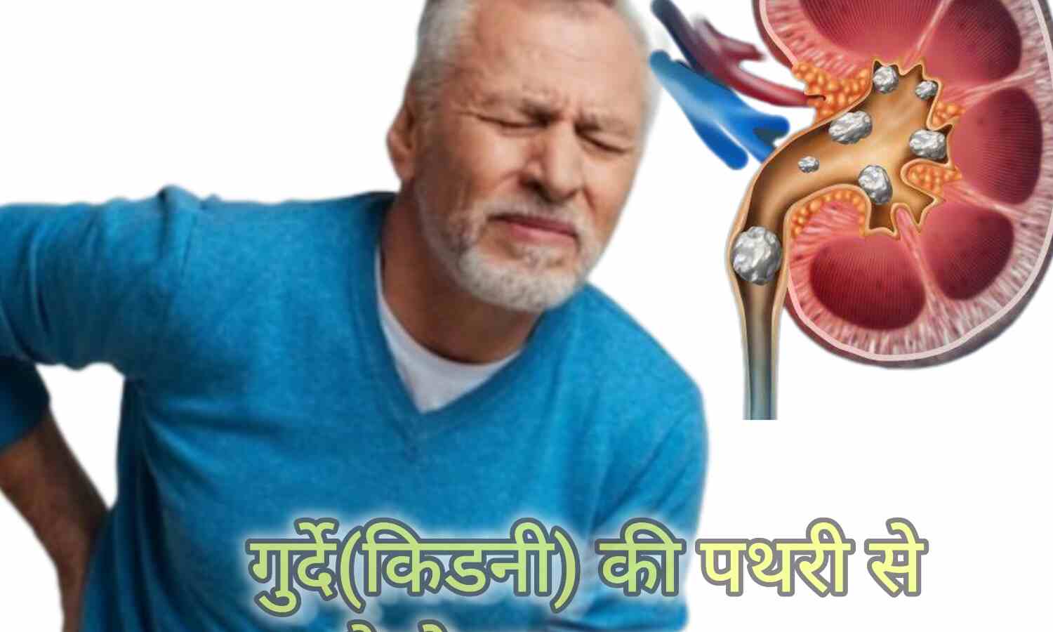 गुर्दे में पथरी के कारण, लक्षण और उपचार