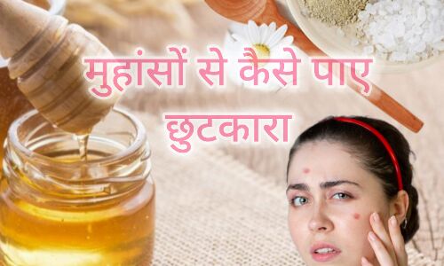 मुँहासे, सुंदरता में दाग और उनसे छुटकारा पाने के उपाय