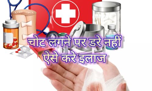 छोटी-मोटी चोट लगने पर क्या करें? घबराएं नहीं, ये घरेलू उपाय आएंगे काम