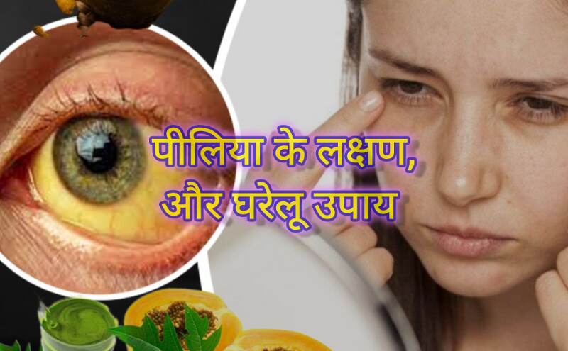 पीलिया: लक्षण और घरेलू उपाय