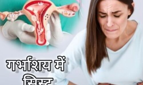 महिलाओं के गर्भाशय में सिस्ट क्या होता है?