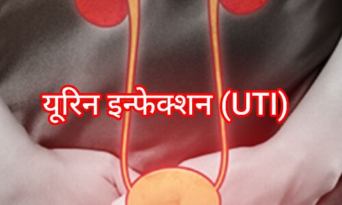 यूरिन इन्फेक्शन (UTI): लक्षण, कारण और उपाय यूरिन इन्फेक्शन (UTI): लक्षण, कारण और उपाय