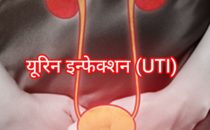 यूरिन इन्फेक्शन (UTI): लक्षण, कारण और उपाय यूरिन इन्फेक्शन (UTI): लक्षण, कारण और उपाय