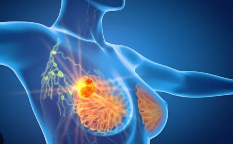 स्तन कैंसर की घर पर जांच कैसे करें