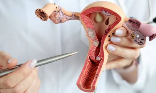 शमिता शेट्टी जुझ रही एंडोमेट्रियोसिस से, आइए जानते है इस बीमारी के बारे में शमिता शेट्टी जुझ रही एंडोमेट्रियोसिस से, आइए जानते है इस बीमारी के बारे में