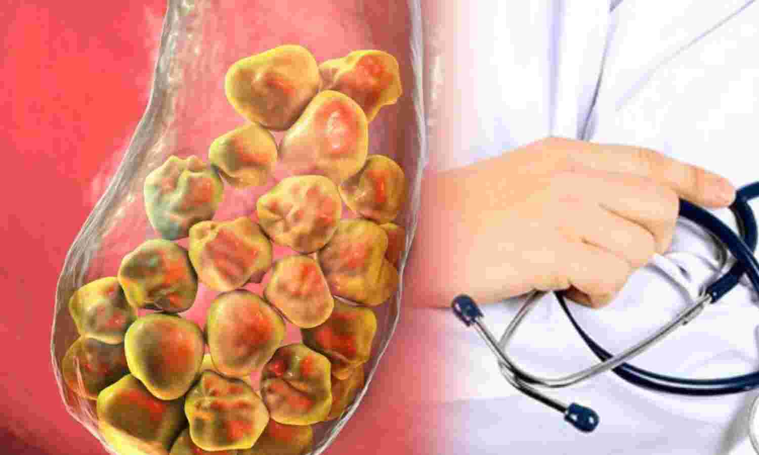 पित्ताशय की थैली निकालने के बाद पाचन संबंधी समस्याओं से कैसे बचें