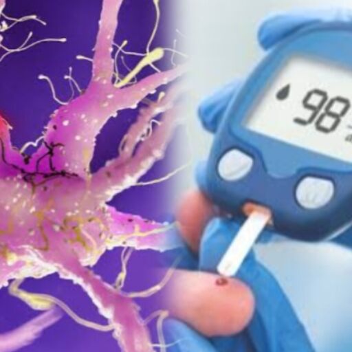 मधुमेह और नर्व डैमेज, जानिए लक्षण और बचाव के तरीके मधुमेह और नर्व डैमेज, जानिए लक्षण और बचाव के तरीके