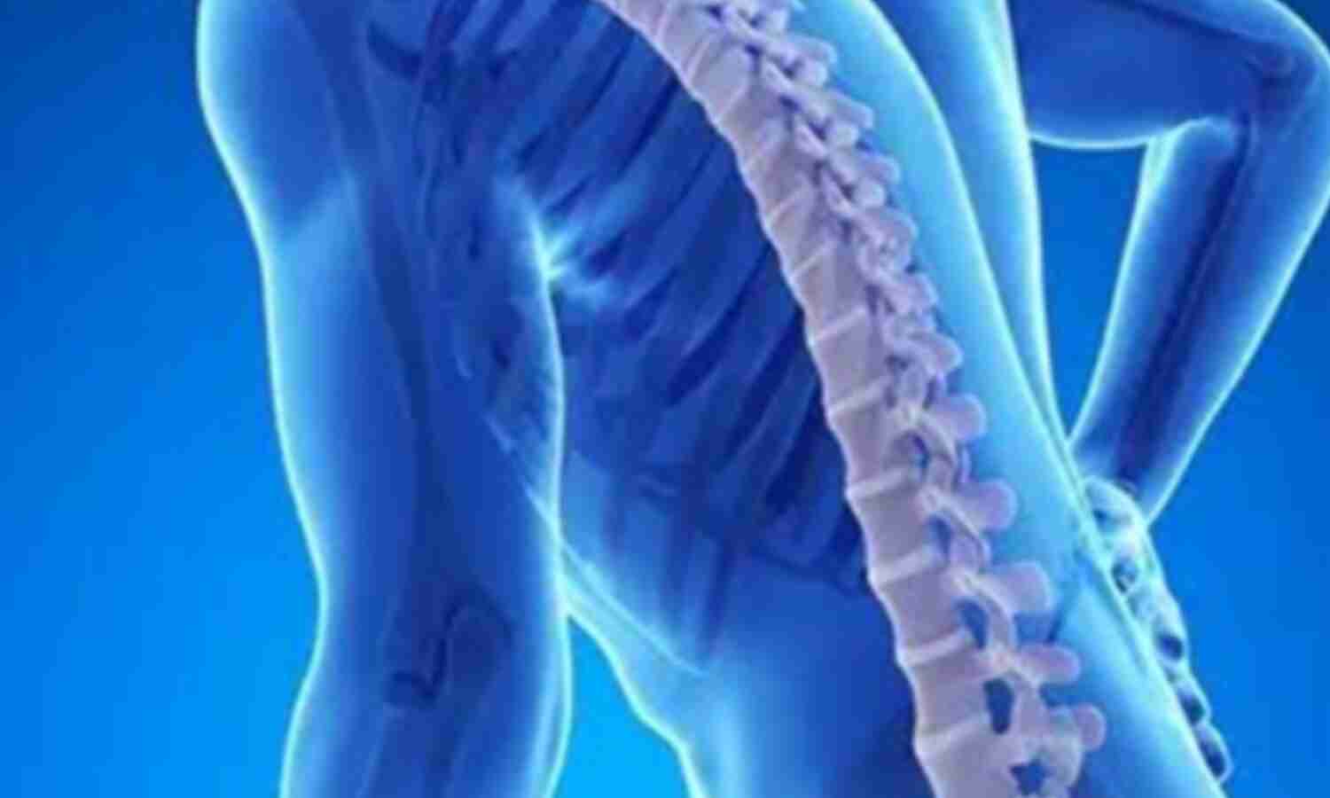ऑस्टियोपोरोसिस, हड्डियों को कमजोर बनाने वाली बीमारी