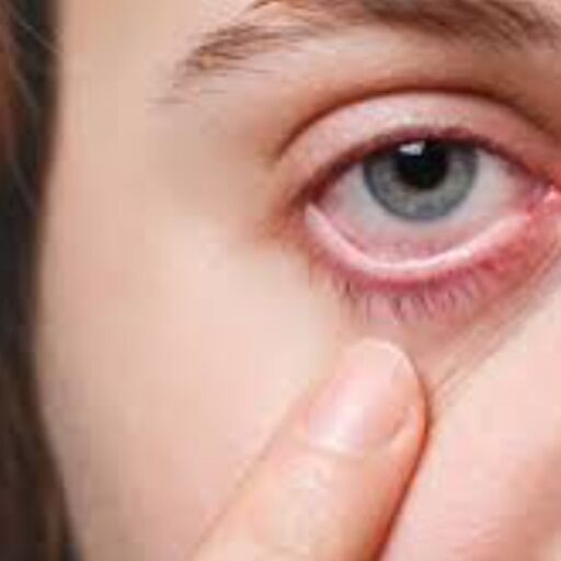 बारिश के मौसम में आंखों का ख्याल, आयुर्वेदिक उपाय