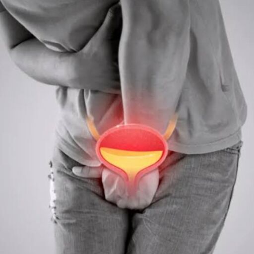 मानसून में बढ़ जाता है UTI का खतरा, जानें बचाव के उपाय!