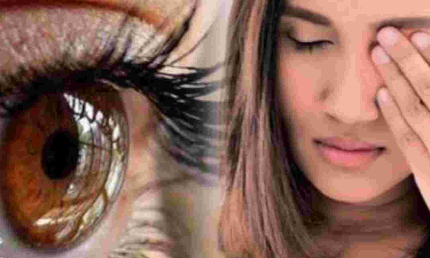 आंखों की सूखापन (ड्राई आई सिंड्रोम) से जुड़ी बीमारी,  और जागरूकता