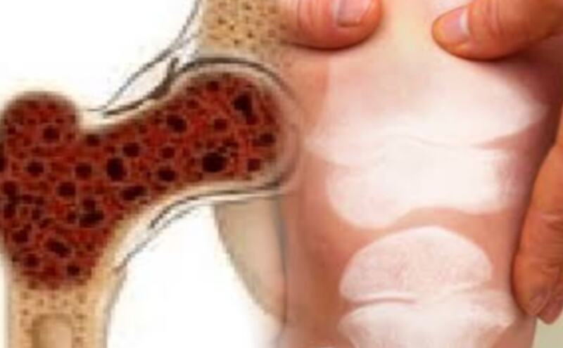 हड्डी का कैंसर (बोन कैंसर) लक्षण और इलाज