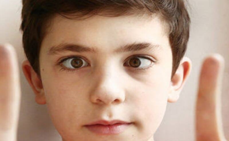 आंखों में भेंगापन (Squint) एक आम समस्या, लक्षणों को पहचानें और जल्द करें इलाज