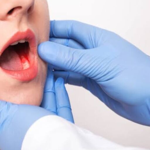 मुंह का कैंसर की समय पर पहचान और उपचार ही है बचाव मुंह का कैंसर की समय पर पहचान और उपचार ही है बचाव