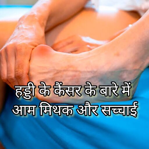 हड्डी के कैंसर के बारे में आम मिथक और सच्चाई