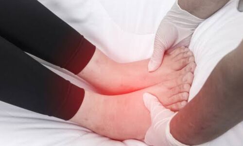 पैरों में दर्द और सूजन डायबिटीज का एक संकेत? पैरों में दर्द और सूजन डायबिटीज का एक संकेत?