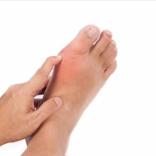 पेशाब में ये समस्याएं हो सकती हैं बढ़े हुए यूरिक एसिड का संकेत