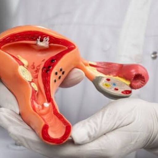 सर्वाइकल कैंसर से रिकवरी के बाद गर्भधारण, भारतीय महिलाओं के लिए महत्वपूर्ण जानकारी सर्वाइकल कैंसर से रिकवरी के बाद गर्भधारण, भारतीय महिलाओं के लिए महत्वपूर्ण जानकारी