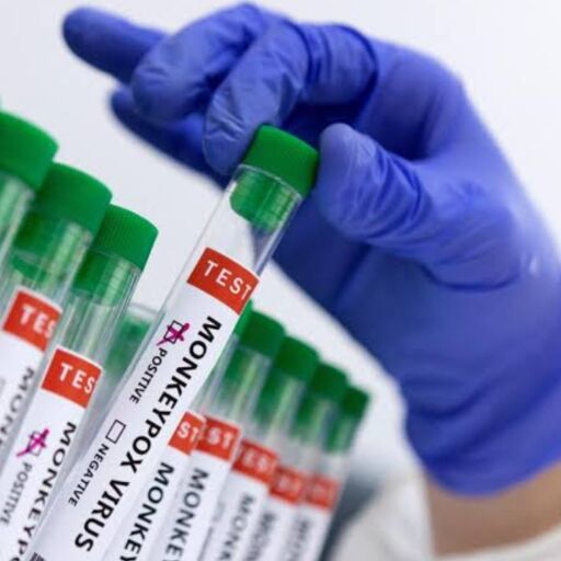 एमपॉक्स का बढ़ता खतरा, भारत में क्या है स्थिति? एमपॉक्स का बढ़ता खतरा, भारत में क्या है स्थिति?