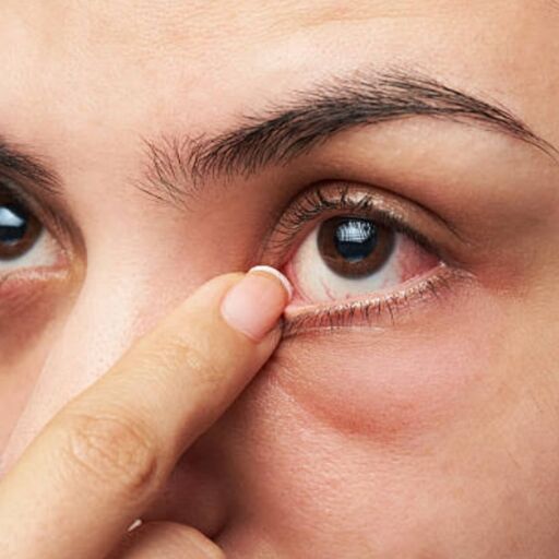 विटामिन बी12 की कमी से आंखों में दिखते हैं ये संकेत