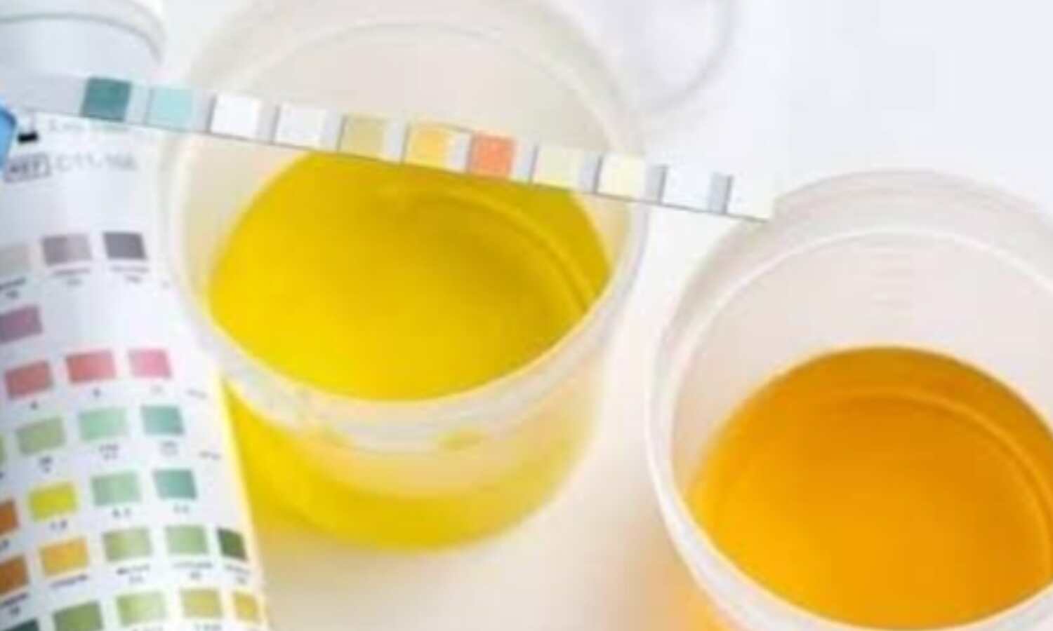 पेशाब का रंग आपकी सेहत की कहानी  करता है बयां