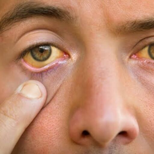 भारत ने किया ऐतिहासिक काम, ट्रेकोमा बीमारी से पूरी तरह पाया छुटकारा