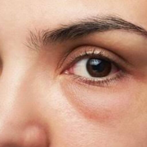 рдЖрдВрдЦреЛрдВ рд╕реЗ рдкрд╣рдЪрд╛рдиреЗрдВ рдерд╛рдпрд░реЙрдЗрдб рдХреА рд╕рдорд╕реНрдпрд╛рдУрдВ рдХреЛ рдФрд░ рд╕рдордп рдкрд░ рдкрд╣рдЪрд╛рди рдХрд░ рдХрд░реЗрдВ рдЗрд▓рд╛рдЬ рдЖрдВрдЦреЛрдВ рд╕реЗ рдкрд╣рдЪрд╛рдиреЗрдВ рдерд╛рдпрд░реЙрдЗрдб рдХреА рд╕рдорд╕реНрдпрд╛рдУрдВ рдХреЛ рдФрд░ рд╕рдордп рдкрд░ рдкрд╣рдЪрд╛рди рдХрд░ рдХрд░реЗрдВ рдЗрд▓рд╛рдЬ