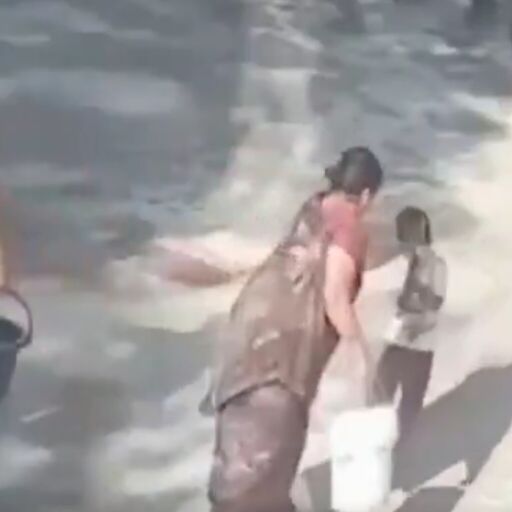 नागपुर में दिल दहला देने वाली घटना: दादी ने 4 साल के पोते पर डाला खौलता पानी, 45% तक झुलसा मासूम