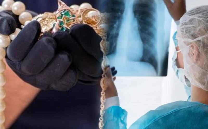 बरेली में अपराधी की एक अजीबोगरीब जिद ने पुलिस को डाला हैरत में, सबूत छिपाने के लिए पार की सारी हदें