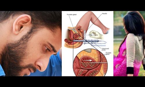 स्वास्थ :युवाओं में काफी तेजी से फैल रही है ये बीमारी, जल्दी करवा लें टेस्ट वरना कभी मल मूत्र नहीं कर पाएंगे