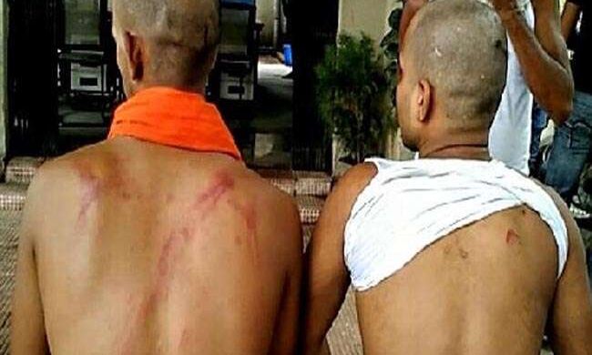 बिहार में RJD नेता की हैवानियत: दो लड़कों को पेड़ से बांधकर पीटा, सिगरेट से दागा