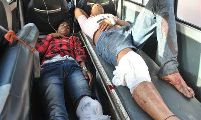 UP के आजमगढ़ में पुलिस मुठभेड़ में घायल हुए दो बदमाश, चार गिरफ्तार