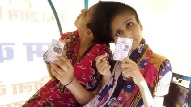 इस तरह हुआ मतदान, अलग-अलग वोट, सिर से जुडी बहनों ने दिए...