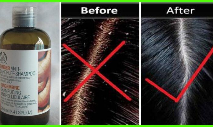 ये हैं 5 बेस्ट हर्बल शैम्पू जो आपके बालों को रखेंगे हमेशा डैंड्रफ से दूर
