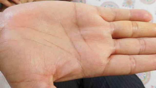 आपकी हथेली का रंग बताएगा आपका हाल