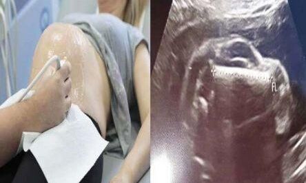 इस महिला के पेट में बच्चा नहीं बल्कि पल रही थी ये भयानक चीज...