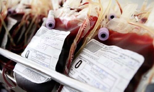 वाराणसी में खुलेगा उत्तर प्रदेश का पहला स्किन बैंक, ब्लड बैंक की तर्ज पर करेगा काम