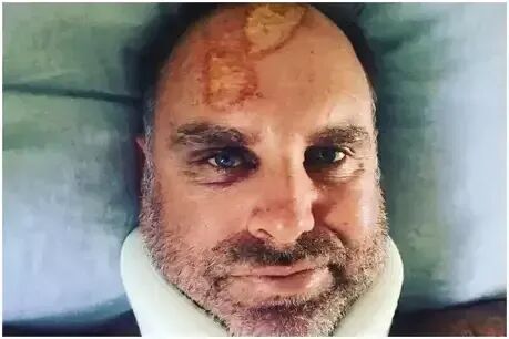 ऑस्ट्रेलियाई दिग्गज क्रिकेटर के सिर में लगी गंभीर चोट, ऐसा हो गया है हाल...