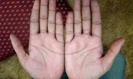 अगर आपकी हथेली पर भी है ये निशान, तो कम उम्र में आपको अमीर बनने से कोई नहीं रोक सकता