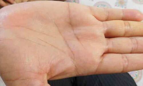 आपकी हथेली का रंग बताएगा आपका हाल