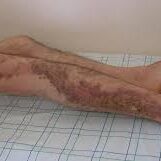 सावधान यूरोप की ये बीमारी पहुंच चुकी है यूपी