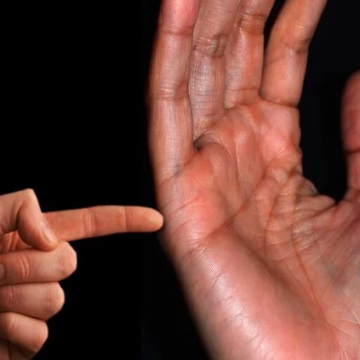 जानिए क्या कहती है आपकी विवाह रेखा, होगी शादी या रहना पड़ेगा कुंवारा