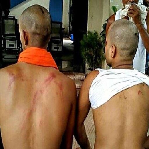 बिहार में RJD नेता की हैवानियत: दो लड़कों को पेड़ से बांधकर पीटा, सिगरेट से दागा