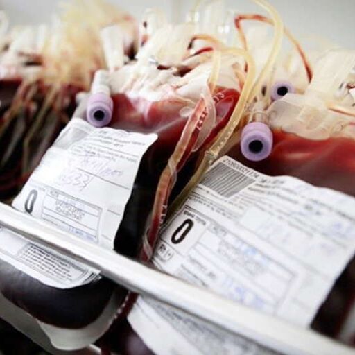 वाराणसी में खुलेगा उत्तर प्रदेश का पहला स्किन बैंक, ब्लड बैंक की तर्ज पर करेगा काम वाराणसी में खुलेगा उत्तर प्रदेश का पहला स्किन बैंक, ब्लड बैंक की तर्ज पर करेगा काम