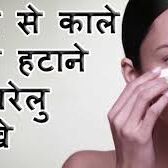 चेहरे के काले धब्बे इन चीज़ों से करें दूर...जानिए उपाय चेहरे के काले धब्बे इन चीज़ों से करें दूर...जानिए उपाय